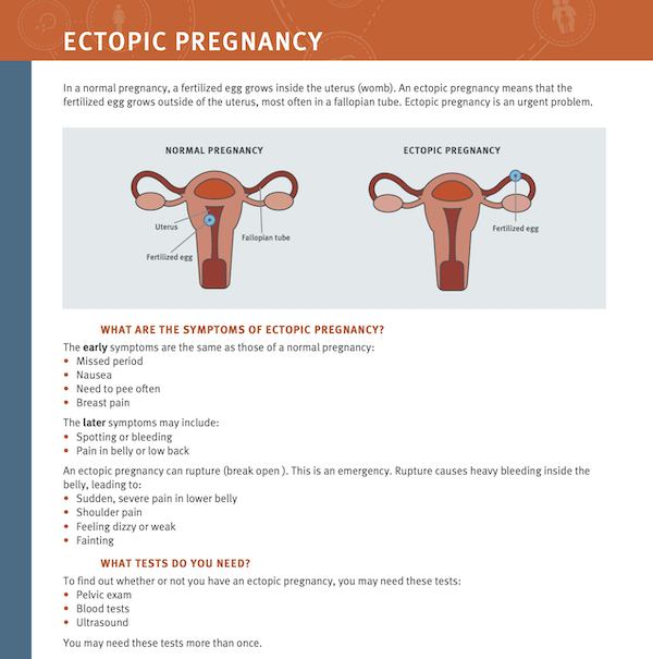 presentation of ectopic pregnancy